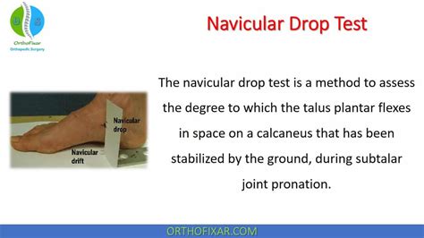 the navicular drop test|navicular drop test pdf.